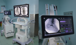 Uşak Eğitim ve Araştırma Hastanesine Yeni “C Kollu Skopi” Cihazı Kazandırıldı