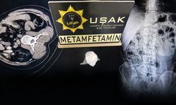 Zehir Taciri Yasaklı Maddeyi Midesinde Saklamış