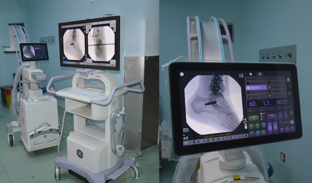 Uşak Eğitim ve Araştırma Hastanesine Yeni “C Kollu Skopi” Cihazı Kazandırıldı